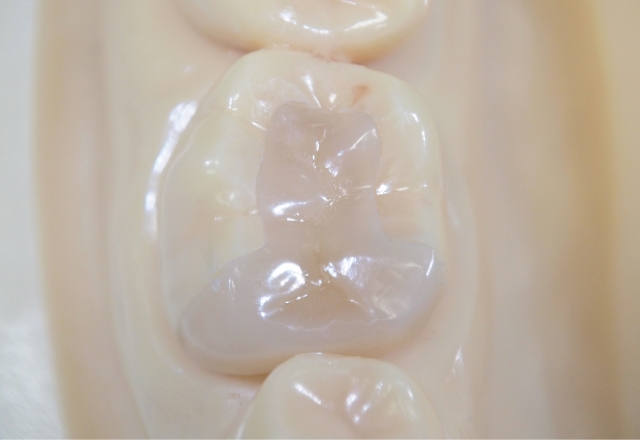 白い詰め物のイメージ画像